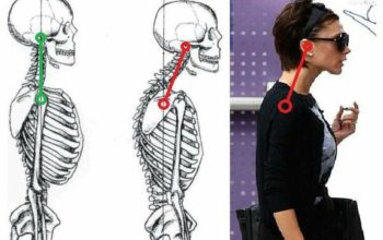 Mengenal Lebih Dalam Temporomandibular Joint Syndrome: Fakta Tentang Sendi Rahang